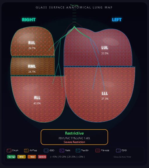 Glass-surface anatomical lung map with per-lobe percentages and a restrictive spirometry summary